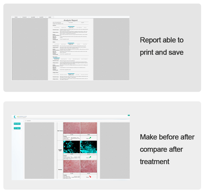 before after compare