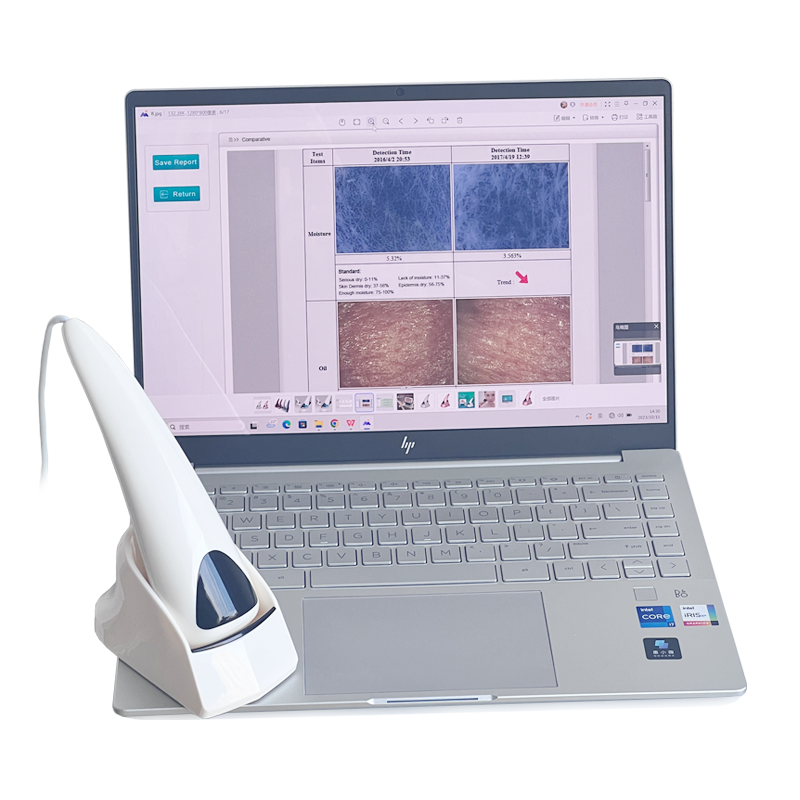 Skin analysis machine