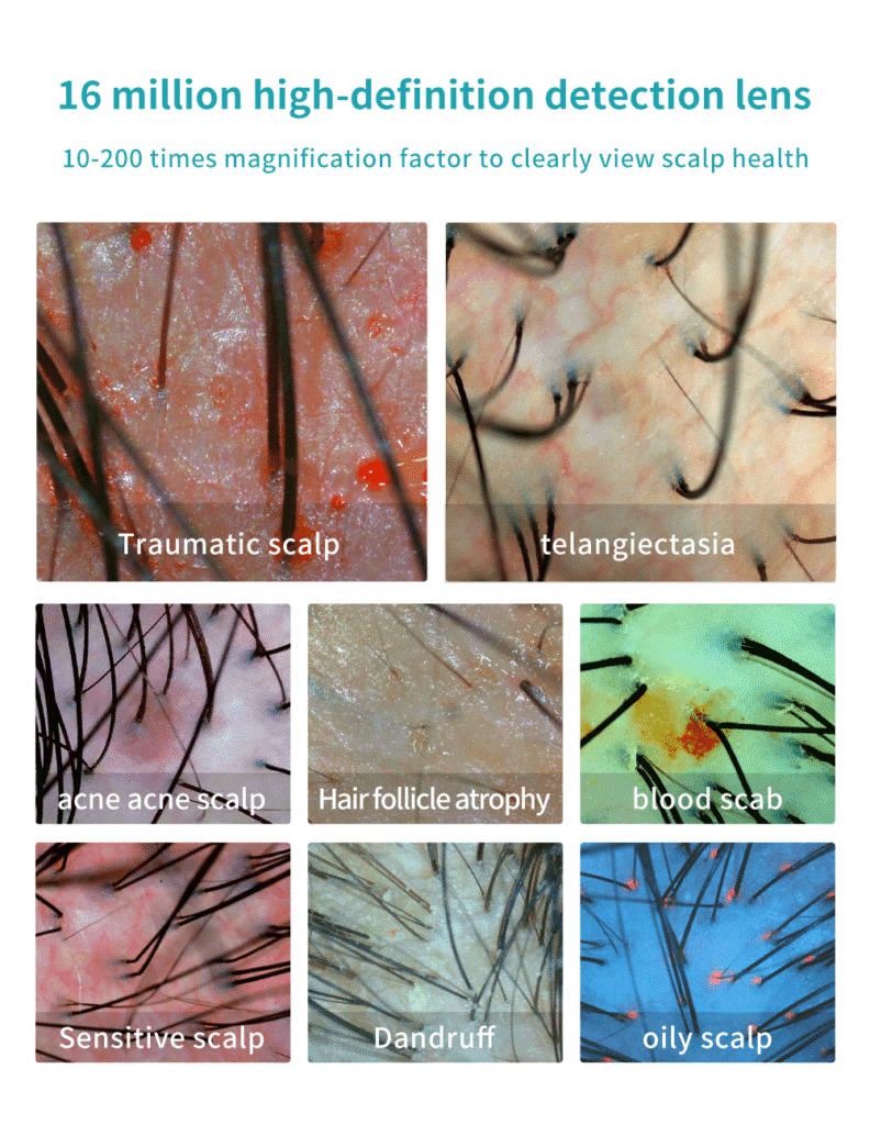 AI hair analyzer