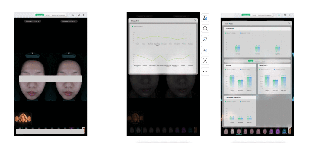 AI skin analyzer 