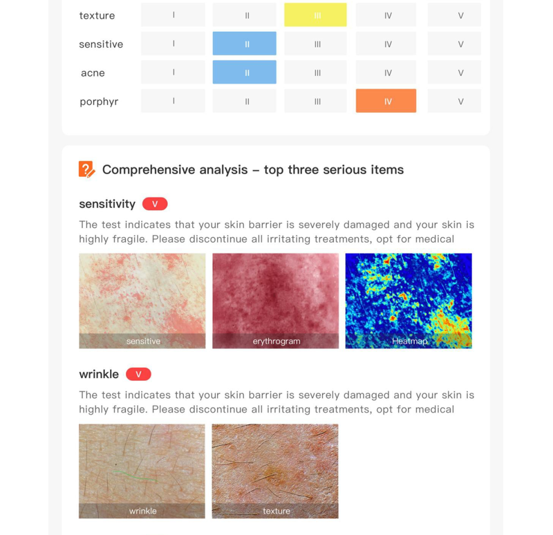 AI hair analyzer
