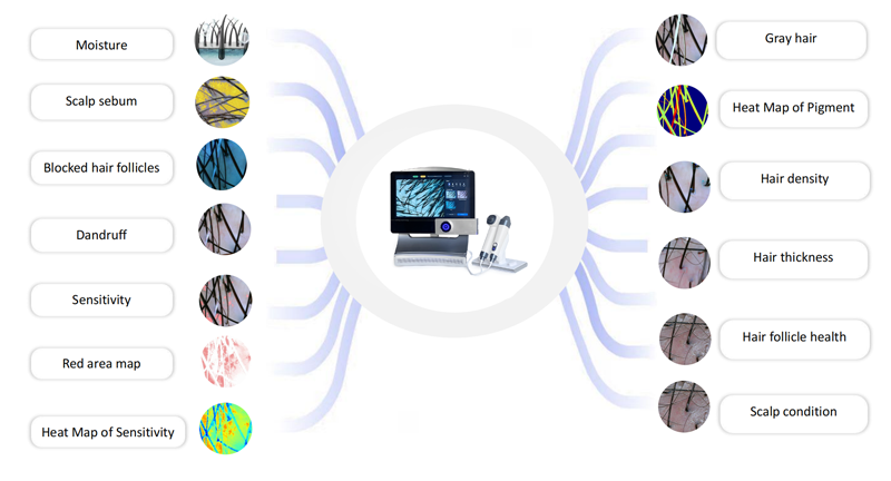 AI hair scalp analyzer report