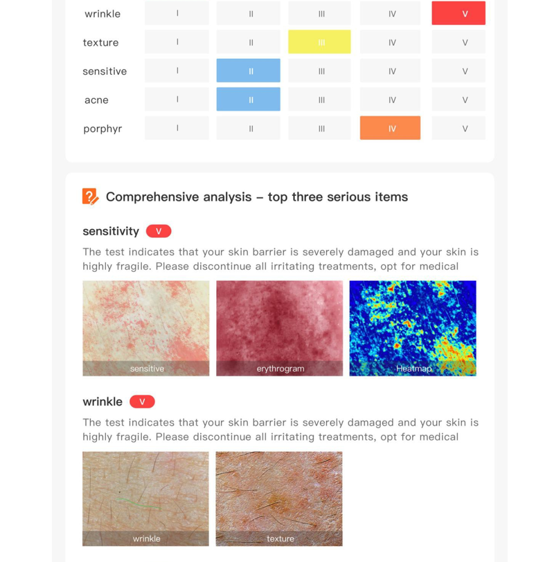 skin analyzer machine