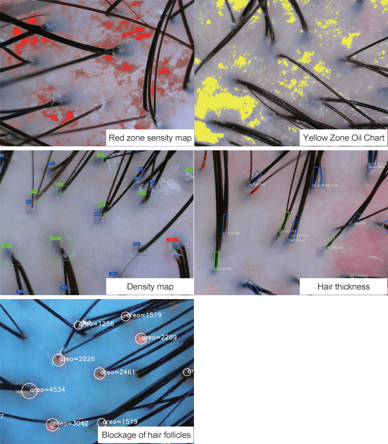 hair analyzer AI detecting map