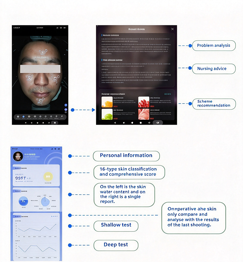 AI skin analyzer report